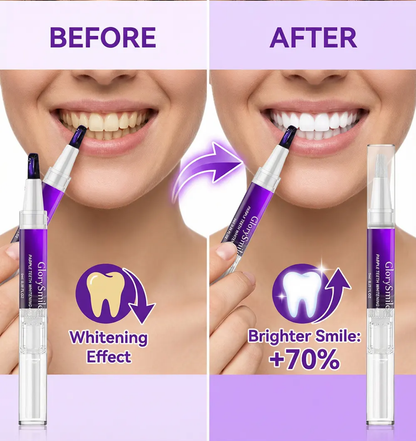 Stylo Blanchissant Violet – Sourire Éclatant Instantané